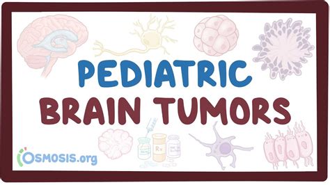 Pediatric brain tumors: Video, Causes, & Meaning | Osmosis