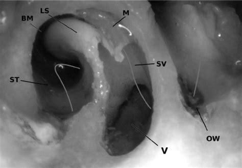 An opening of the lambs’ round window (left ear). The stapes has been ...