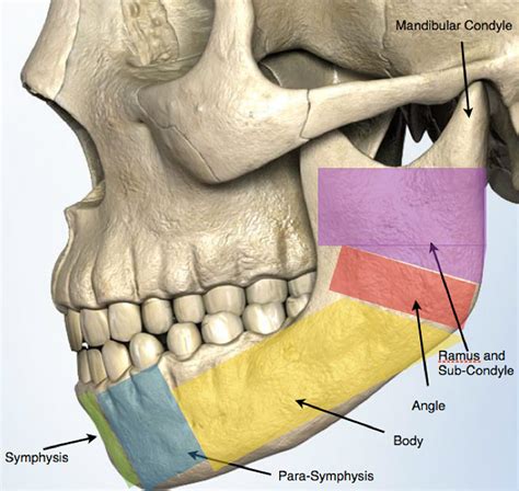 Jaw Fracture - Facial Trauma