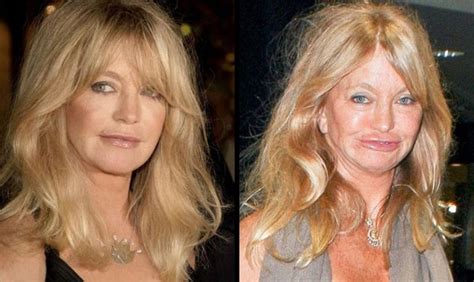 21 celebrities with botched plastic surgery - Eww Gallery | eBaum's World