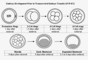 rossafeick – Frozen Embryo Transfer Procedures