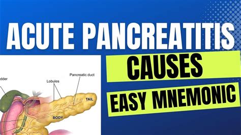 Acute Pancreatitis | Causes | Easy Mnemonic - YouTube