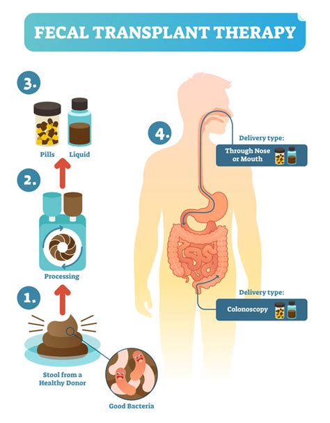 FECAL TRANSPLANTS FOR IBD AND FOR C DIFF INFECTIONS - Nutrition 4 IBD