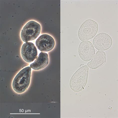 Renal Transitional Epithelial Cells