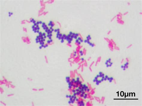 Gram stain - Wikipedia