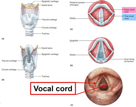 Vocal Cord Paralysis - Causes, Symptoms, Recovery, Surgery, Treatment