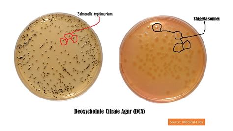 Deoxycholate Citrate Agar (DCA): Introduction, Principle, Composition, Test