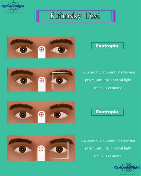 modified krimsky corneal reflex test Archives - OptomInSight