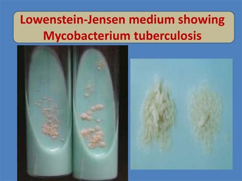 PPT - Mycobacterium tuberculosis & pulmonary tuberculosis PowerPoint ...