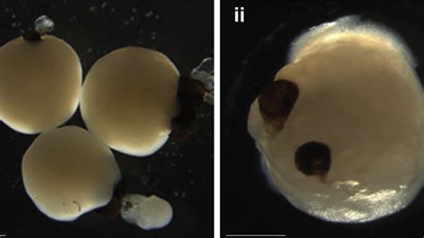 Lab-grown mini brains develop 'eyes' that could solve child blindness ...