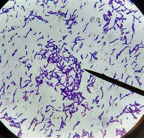 Bacillus. Large gram positive rod-shaped bacteria.