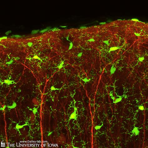 Are Microglia the Most Intelligent Brain Cells