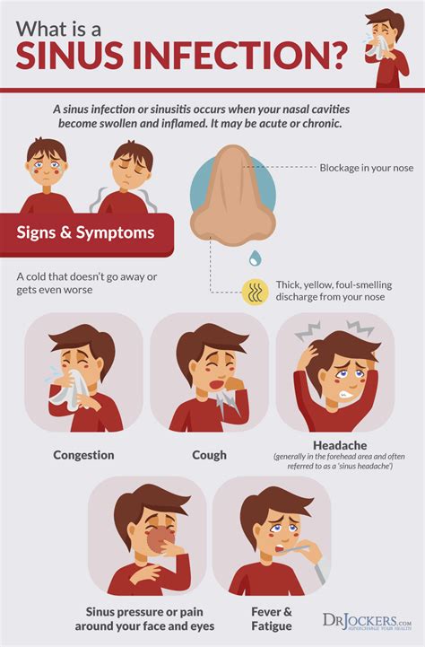 Sinus Infections: Causes, Symptoms & Natural Support Strategies