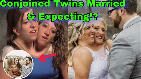 Is Abby and Brittany married? – Life Set Go