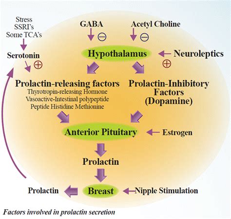 Pituitary Tumor: Pituitary Tumor High Prolactin