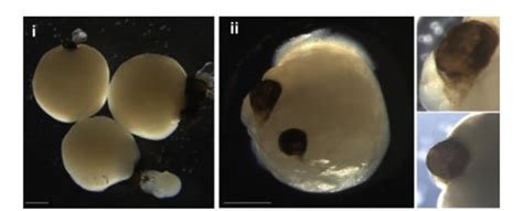 Scientists grew 'mini-brains from stem cells. Then the brains sort of ...