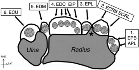 Dorsal extensor tendons of the wrist in their six (1 -6 | Open-i