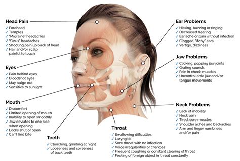 Sharp Pain Under Cheek Bone at Willie Wickman blog