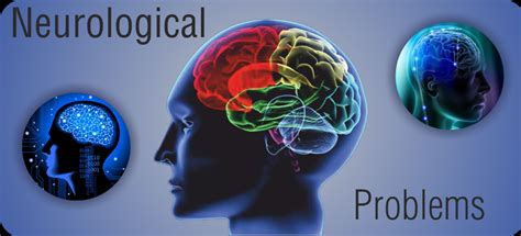 Neurological Problems Causes and Symptoms – My Blog