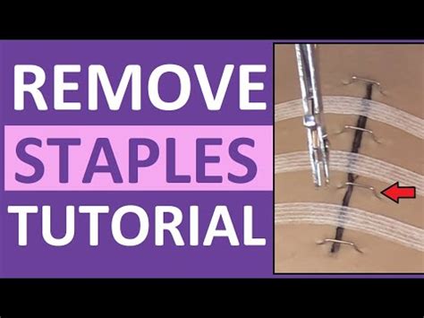 Surgical Staple Removal Nursing | How to Remove Surgical Staples - YouTube