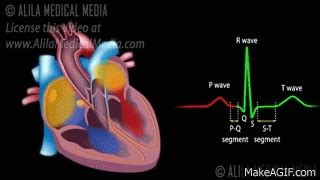 Cardiac Conduction System and Understanding ECG, Animation. on Make a GIF