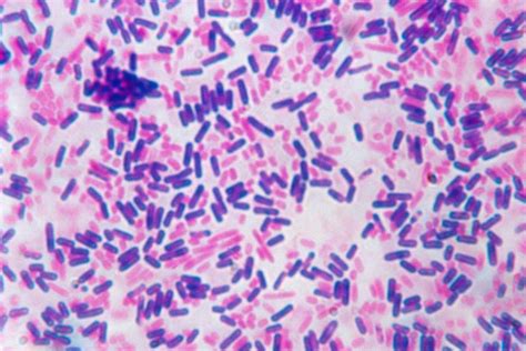 Gram Stain Procedure in Research and Labs