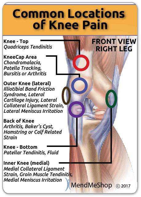 Meniscus Tear Diagnosis