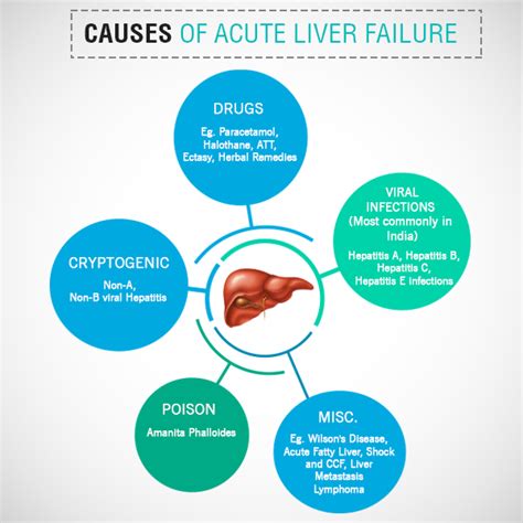 Acute Liver Failure | Treatments, Symptoms and Causes - ailbsindia.com