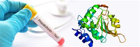 WHAT IS THE PROCALCITONIN TEST - JMitra & Co. Pvt. Ltd.