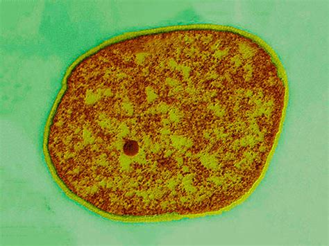 Kingdom of Archaea | CDC