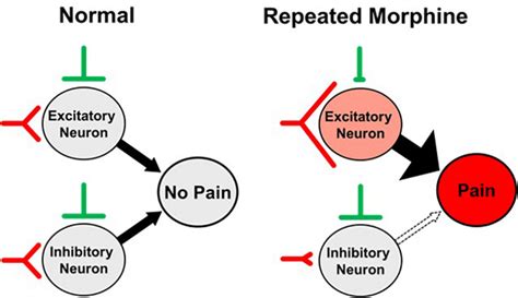 Proposed synaptic mechanism of opioid-induced hyperalgesia (OIH ...