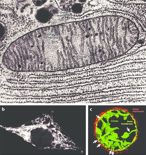 Electron Micrograph Of Mitochondria Labelled