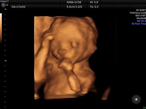 Week by Week Ultrasound Gallery - 2D 3D 5D Visual Pictures