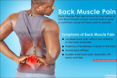 Rhomboid muscle strain treatment - trackingnaa