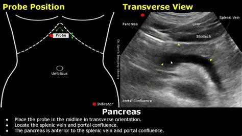 Pancreas Ultrasound Probe Positioning | Transducer Placement & Scanning ...