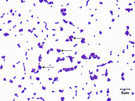 Staphylococcus Epidermidis Gram Stain