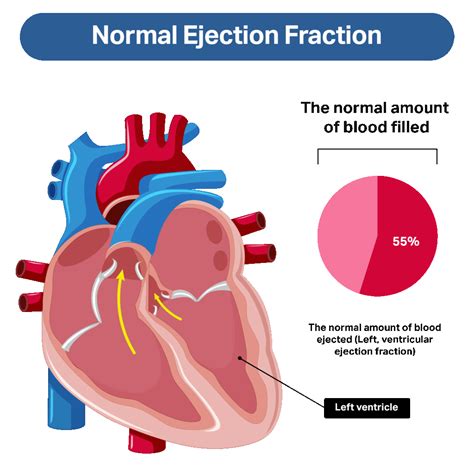 Medical Treatment of Chronic Stable Heart Failure with Reduced Ejection ...