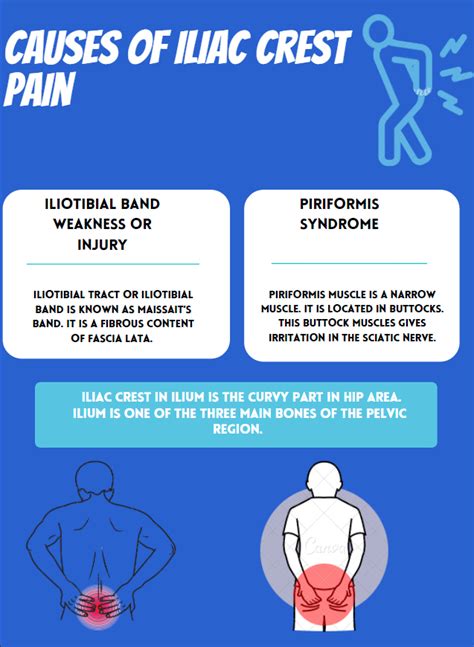 Iliac Crest Pain Syndrome