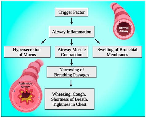 Diagnostics | Free Full-Text | Severe Acute Bronchial Asthma with ...