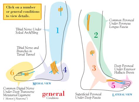 Gallery For > Foot Pain Diagram