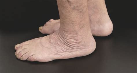 Aging Feet Changes And Problems FAQ | UgleeFeet