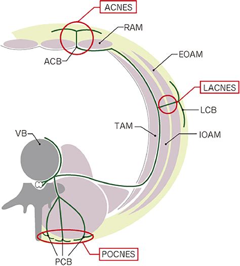 Lateral Cutaneous Nerve Entrapment Syndrome (LACNES) - The American ...