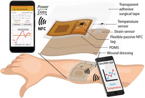 Smart Bandage With Wireless Strain and Temperature Sensors and ...