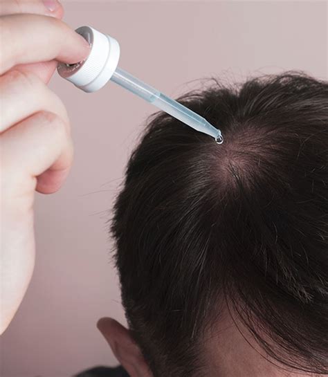 Dry scalp with hair loss: Is there a connection?