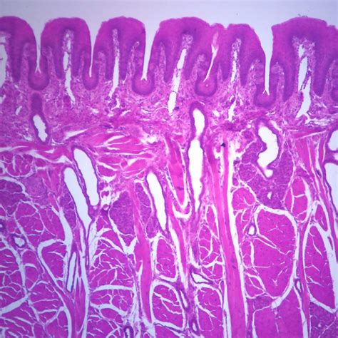 Mammal Tongue, Foliate Papillae with Taste Buds, sec. 7 µm, H&E ...