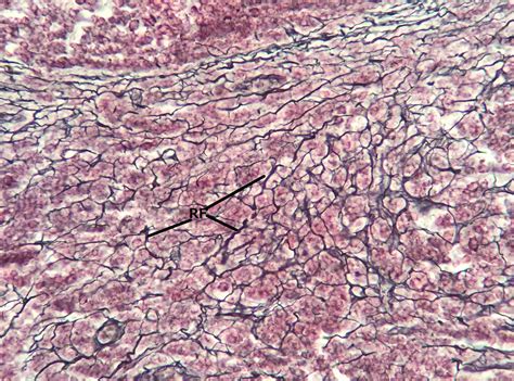 Reticular Connective Tissue 20x | Histology