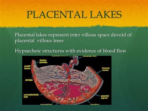 Radiological evaluation of the Placenta