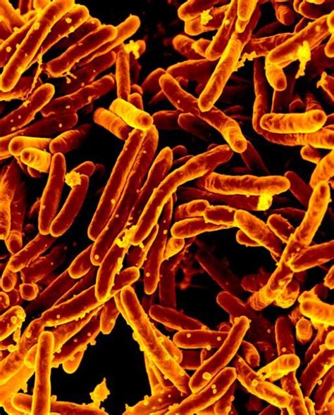 Mycobacterium tuberculosis Bacteria, the Cause of TB Scanning electron ...