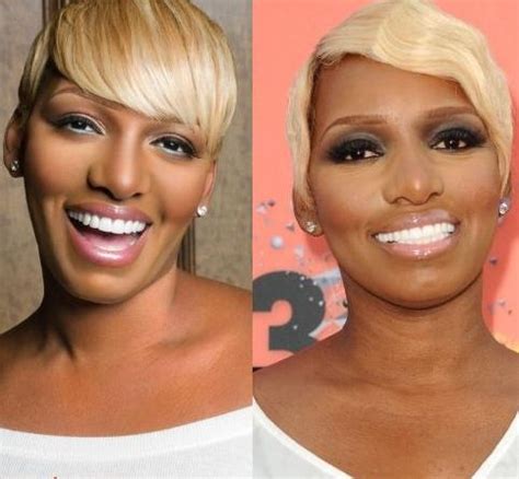 40+ Celebrities with Veneers - Body Art Guru