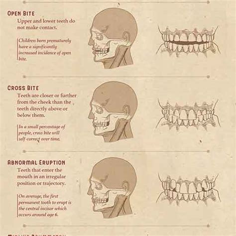 Common Bite Problem Identification Chart - Dusty Info